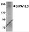 Signal Induced Proliferation Associated 1 Like 3 antibody, 5495, ProSci, Western Blot image 