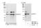 DnaJ Heat Shock Protein Family (Hsp40) Member C2 antibody, NBP2-12802, Novus Biologicals, Western Blot image 