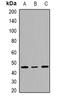 SWI/SNF Related, Matrix Associated, Actin Dependent Regulator Of Chromatin, Subfamily B, Member 1 antibody, orb382643, Biorbyt, Western Blot image 