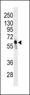 6-Phosphofructo-2-Kinase/Fructose-2,6-Biphosphatase 3 antibody, PA5-15456, Invitrogen Antibodies, Western Blot image 