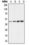 Aldehyde Dehydrogenase 3 Family Member B2 antibody, LS-C351810, Lifespan Biosciences, Western Blot image 