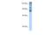 Homeodomain Interacting Protein Kinase 2 antibody, PA5-40567, Invitrogen Antibodies, Western Blot image 