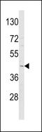 Adiponectin Receptor 1 antibody, 63-559, ProSci, Western Blot image 