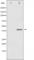 Aurora Kinase B antibody, abx010560, Abbexa, Western Blot image 