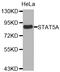 Signal Transducer And Activator Of Transcription 5A antibody, LS-C332693, Lifespan Biosciences, Western Blot image 