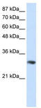 Receptor For Activated C Kinase 1 antibody, TA345945, Origene, Western Blot image 