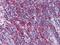 Metadherin antibody, NBP1-51585, Novus Biologicals, Immunohistochemistry paraffin image 