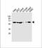 Interferon Alpha And Beta Receptor Subunit 1 antibody, A00306, Boster Biological Technology, Western Blot image 