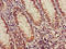 Acyl-CoA Dehydrogenase Medium Chain antibody, LS-C395655, Lifespan Biosciences, Immunohistochemistry paraffin image 
