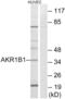 Aldose reductase antibody, abx014171, Abbexa, Western Blot image 