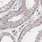 Transmembrane And Coiled-Coil Domains 6 antibody, HPA037474, Atlas Antibodies, Immunohistochemistry frozen image 