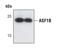 Histone chaperone ASF1B antibody, MA5-14836, Invitrogen Antibodies, Western Blot image 