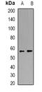Karyopherin Subunit Alpha 4 antibody, orb340814, Biorbyt, Western Blot image 