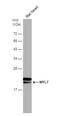 Myosin regulatory light chain 2, atrial isoform antibody, NBP2-19449, Novus Biologicals, Western Blot image 