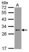 Nucleolar Protein 3 antibody, PA5-29861, Invitrogen Antibodies, Western Blot image 