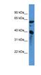 Calponin 3 antibody, NBP1-68944, Novus Biologicals, Western Blot image 