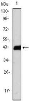 CD247 Molecule antibody, NBP1-42561, Novus Biologicals, Western Blot image 