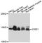 CDGSH Iron Sulfur Domain 1 antibody, A04360, Boster Biological Technology, Western Blot image 