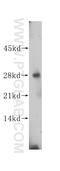 Antagonist Of Mitotic Exit Network 1 Homolog antibody, 14694-1-AP, Proteintech Group, Western Blot image 
