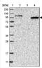 Signal Induced Proliferation Associated 1 Like 2 antibody, NBP1-81412, Novus Biologicals, Western Blot image 