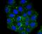 Carnitine Palmitoyltransferase 2 antibody, A02112, Boster Biological Technology, Immunocytochemistry image 