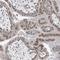 Keratin Associated Protein 25-1 antibody, HPA031438, Atlas Antibodies, Immunohistochemistry frozen image 