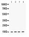 Ring-Box 1 antibody, PB9798, Boster Biological Technology, Western Blot image 