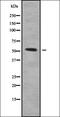 Serpin Family A Member 10 antibody, orb338583, Biorbyt, Western Blot image 