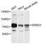 Semenogelin 2 antibody, STJ114692, St John