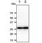 Adenylate kinase 2, mitochondrial antibody, GTX57648, GeneTex, Western Blot image 