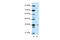 Hypoxia Inducible Factor 1 Subunit Alpha Inhibitor antibody, 29-041, ProSci, Western Blot image 