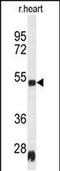 Serpin Family H Member 1 antibody, MA5-24713, Invitrogen Antibodies, Western Blot image 