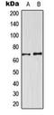 Cyclin Dependent Kinase Like 3 antibody, orb224099, Biorbyt, Western Blot image 