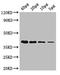 Ribokinase antibody, LS-C316908, Lifespan Biosciences, Western Blot image 