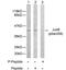 JunB Proto-Oncogene, AP-1 Transcription Factor Subunit antibody, GTX79027, GeneTex, Western Blot image 