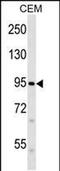 Piezo Type Mechanosensitive Ion Channel Component 2 antibody, PA5-48758, Invitrogen Antibodies, Western Blot image 