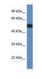 Protein Phosphatase 2 Regulatory Subunit B'Epsilon antibody, orb330883, Biorbyt, Western Blot image 