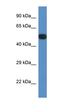 Serine/threonine-protein phosphatase 2A 56 kDa regulatory subunit epsilon isoform antibody, orb330883, Biorbyt, Western Blot image 