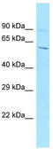 Transmembrane Protein 260 antibody, TA335535, Origene, Western Blot image 