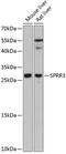 Small Proline Rich Protein 3 antibody, GTX65568, GeneTex, Western Blot image 