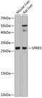 Small proline-rich protein 3 antibody, GTX65568, GeneTex, Western Blot image 