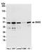 Sorting Nexin 5 antibody, A305-493A, Bethyl Labs, Western Blot image 