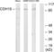 Cadherin-18 antibody, LS-C119410, Lifespan Biosciences, Western Blot image 