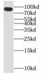 Oxysterol-binding protein 1 antibody, FNab06016, FineTest, Western Blot image 