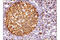 Stathmin 1 antibody, 13655S, Cell Signaling Technology, Immunohistochemistry paraffin image 
