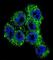 Transient Receptor Potential Cation Channel Subfamily M Member 8 antibody, abx026431, Abbexa, Western Blot image 