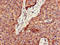 Palmitoyl-Protein Thioesterase 1 antibody, LS-C679135, Lifespan Biosciences, Immunohistochemistry paraffin image 