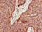 Palmitoyl-protein thioesterase 1 antibody, LS-C679135, Lifespan Biosciences, Immunohistochemistry paraffin image 