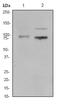 Toll Like Receptor 1 antibody, ab68158, Abcam, Western Blot image 