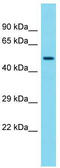 G Protein-Coupled Receptor 89B antibody, TA337328, Origene, Western Blot image 